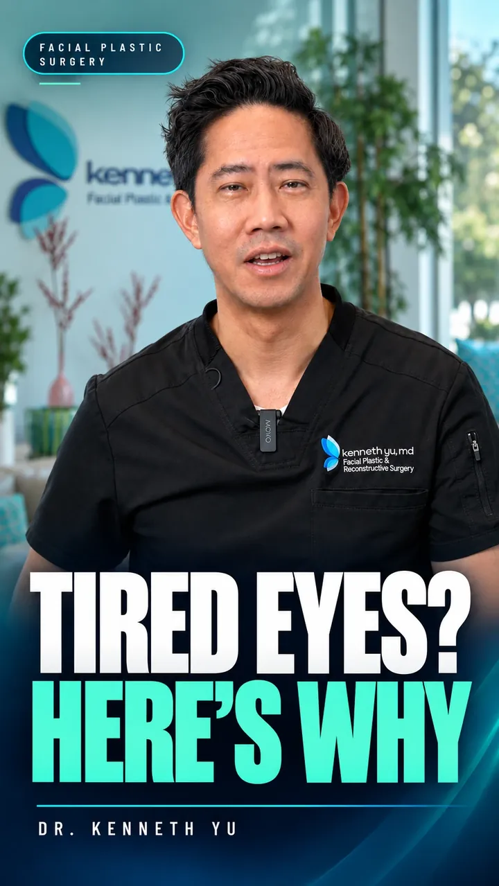 Reel: Tired eyes? Here's why